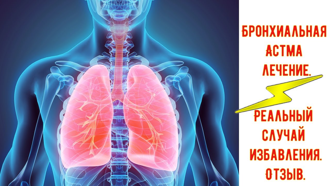 Бронхиальная астма лечение кордицепсом. - YouTube