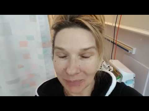 Mouth Cancer Charlie Rees Diary 56 - Week Three Treatment 26/01/2017 ...