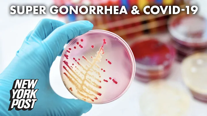 Overuse of antibiotics for COVID-19 to blame in 'super gonorrhea' spike | New York Post