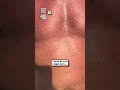 Fire lighting gone wrong 😂🔥🤦                                 🎥: Instagram / jools_sa & vahitov_evgen