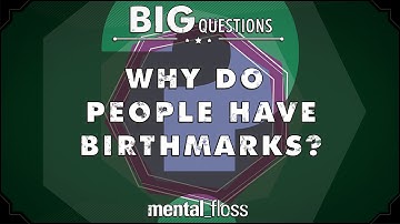 Why do people have birthmarks?  - Big Questions - (Ep. 217) | Mental Floss