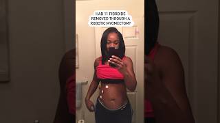 🤯11 FIBROIDS REMOVED! How’s Life Now…#fibroids #fibroidremoval #fitnessmotivation #momoftwins