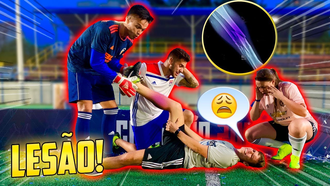 ELE MACHUCOU NA SUPERCOPA DESIMPEDIDOS?!