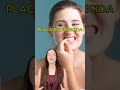Eso Amarillo No Es Mancha: Es Sarro #sarro #tartaro #saludbucal #limpiezadental #higienedental