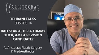 Tehrani Talks Episode 14: Tummy Tuck Scar Revision