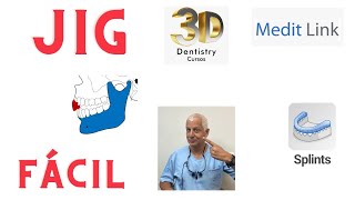 Medit splint JIG de Lucia screenshot 4