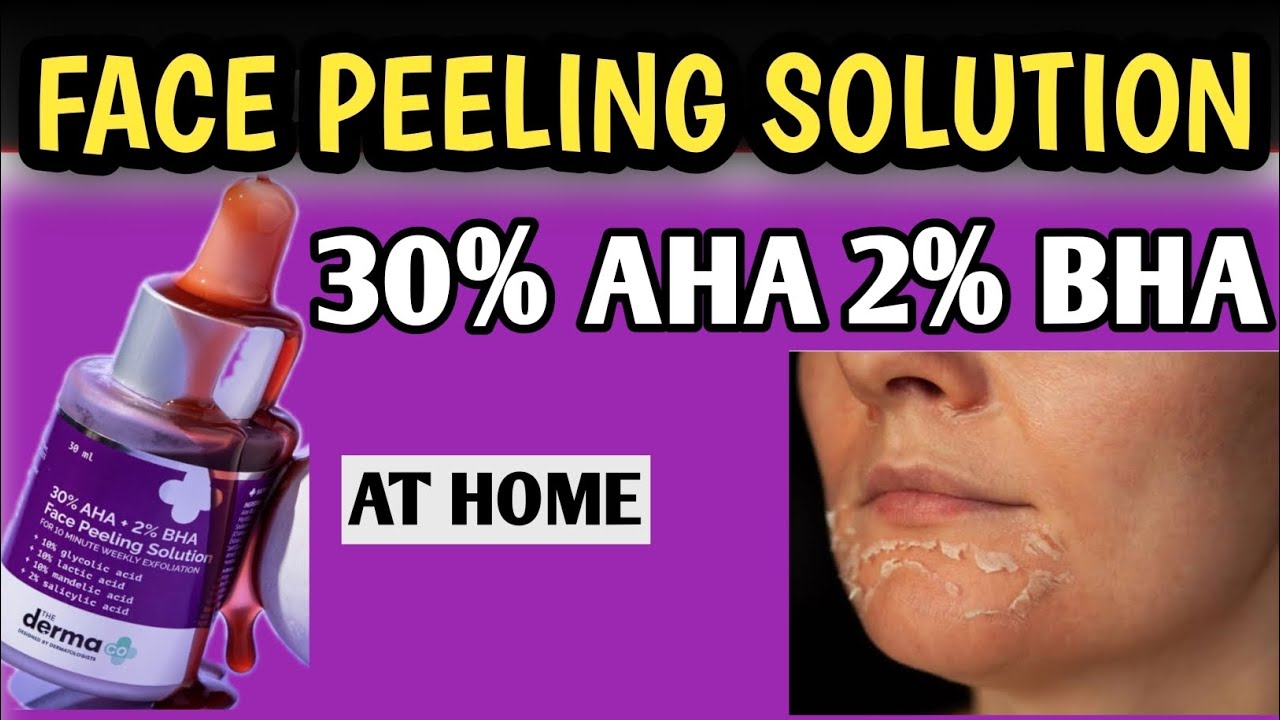 Chemical Peel Treatment for Acne Scars & Pigmentation//Skik Peeling Solution//DERMA 30 AHA 2