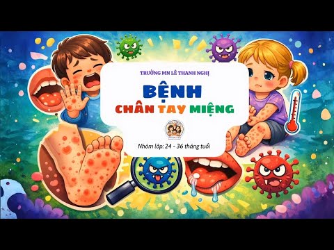 Phòng chống bệnh chân tay miệng ở trẻ mầm non