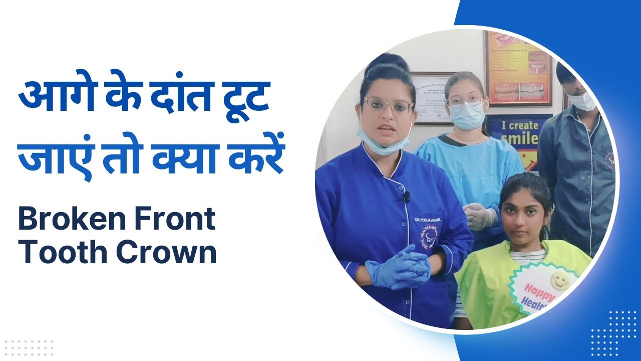 Aage Ke Dant Tut Jaaye To Kya Karen Broken Front Tooth Crown YouTube