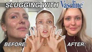 I Applied VASELINE To My Face for 7 DAYS.. (INSANE RESULTS)