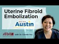 Dr. Hsu shares the benefits of Uterine Fibroid Embolization (UFE)