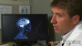 What Is A Concussion?