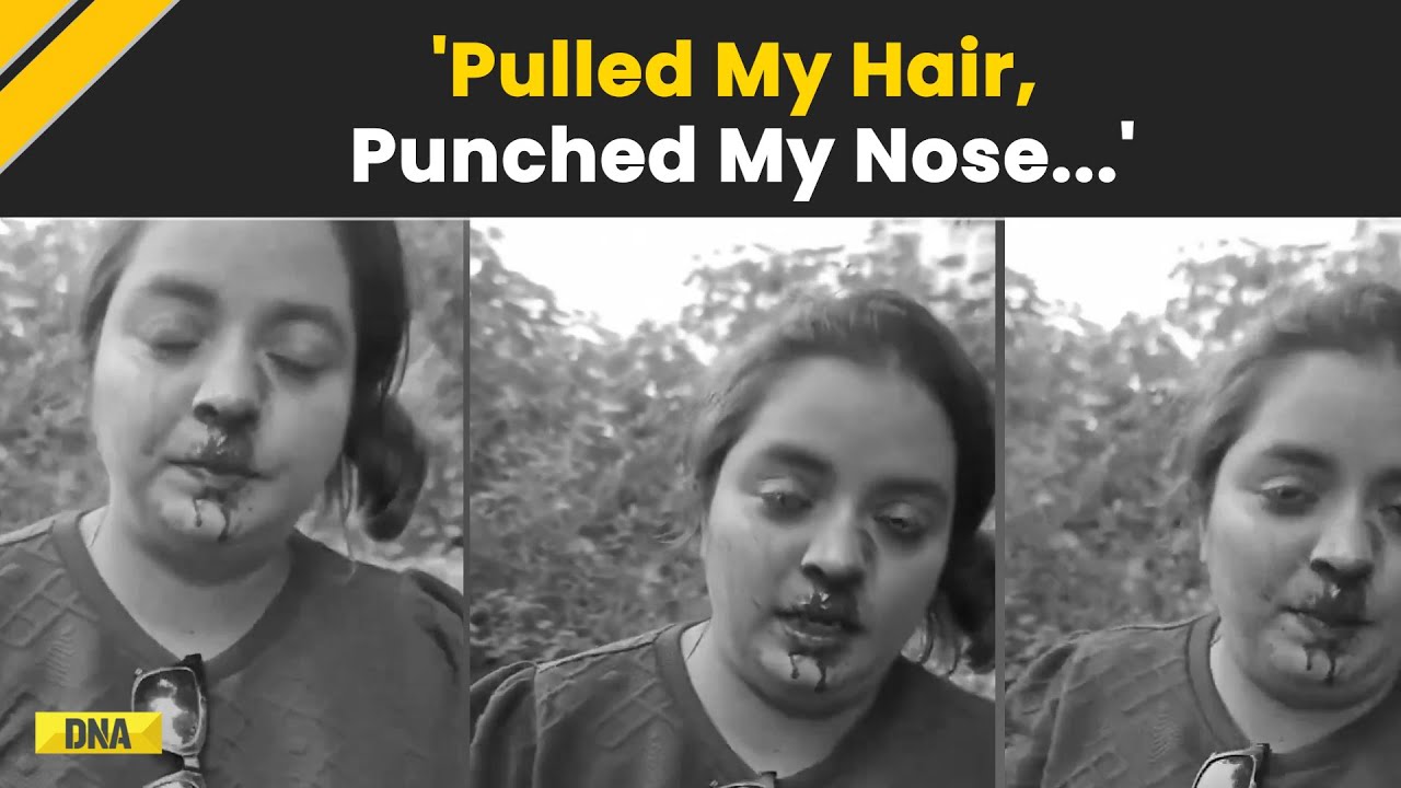 Woman On Scooter With 2 Kids, 'Punched' By A Man, Narrates Pune Road ...