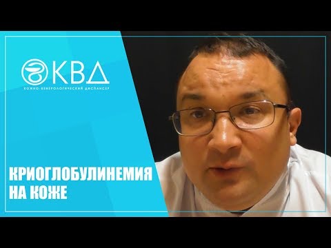 1415  Криоглобулинемия на коже