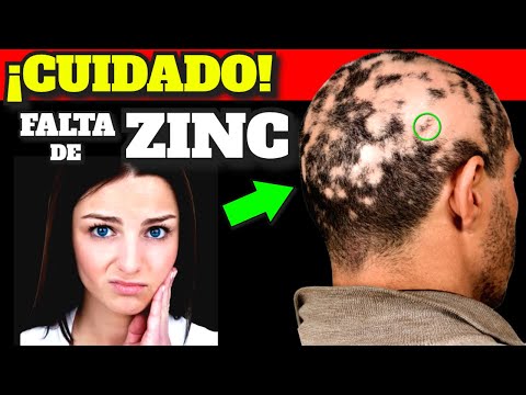 Video: 3 formas de recuperarse de la deficiencia de zinc