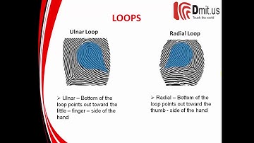 🔴 Midbrain Activation    Unit 3   Basic Fingerprint Patterns  Dmit us ⚡