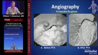 Management of FMD (William T. Bohannon, MD) Saturday, August 20, 2016
