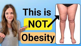 Lipedema. Is It Fat Or Swelling?