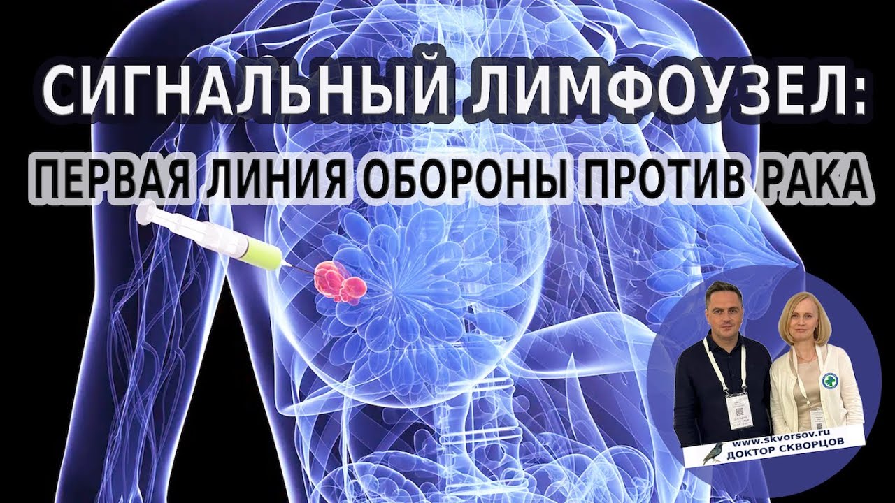 Сигнальный лимфоузел: первая линия обороны против рака!