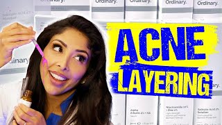 Teen Acne The Ordinary Ampm Layering