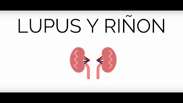 ¿Cómo puedo saber si tengo lupus en los riñones?