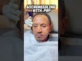 Microneedling with PRP for Musician Getu Omahire #glowethioturkiye #skincare #getu_omahire