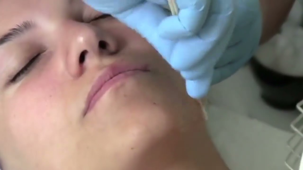 Probiotic skincare is reshaping the approach to skin health!