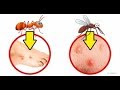 Comment savoir quel insecte ta piqu