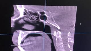 KaVo OP3D Pro - Hawkesbury Dentistry (4) screenshot 3