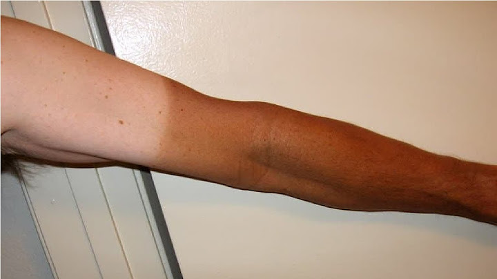 How to get rid of tan on arms