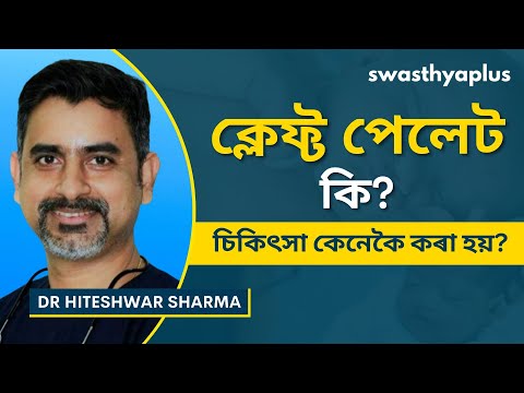 ফাটি যোৱা তালু : চিকিৎসা আৰু কাৰণ | What is Cleft Palate? in Assamese | Dr Hiteshwar Sharma