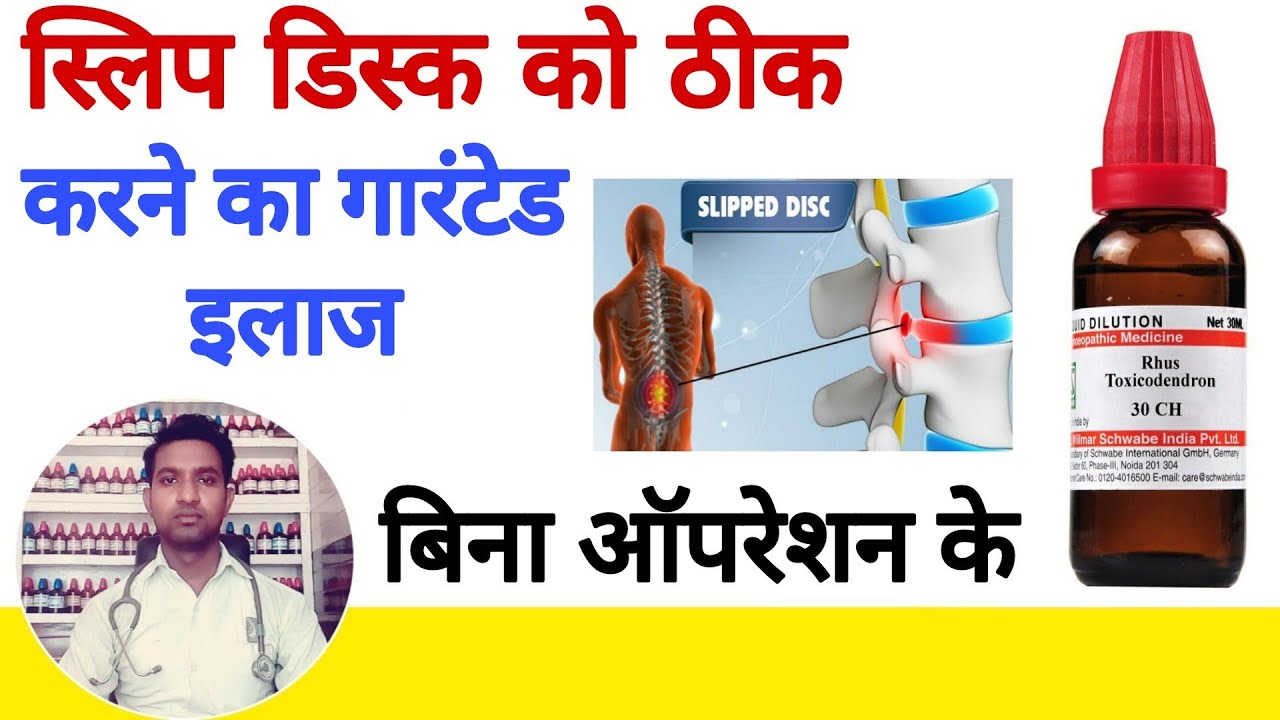 Slip disc homeopathic treatment स्लिप डिस्क का होम्योपैथिक इलाज YouTube