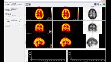 Analyze 14.0 - Process: Histogram Normalization