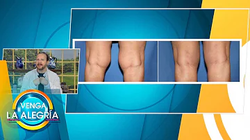 ¿Qué es la grasa detrás de la rodilla?