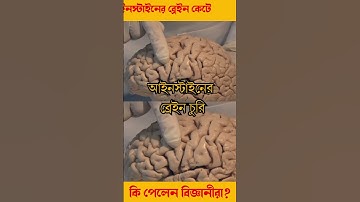 আইনস্টাইনের ব্রেইন কেটে কি পাওয়া গেল? How Albert Einstein Brain Is Really Different #shorts#history