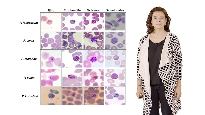 Maria Mota (IMM) 3: Nutrient sensing modulates mal...