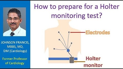 How to prepare for a Holter monitoring test?