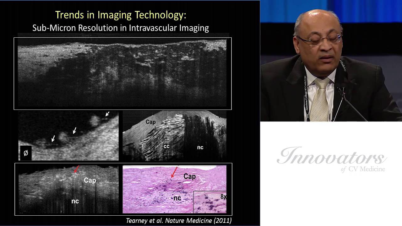 Legends of CV Medicine | Jagat Narula, MD, PhD