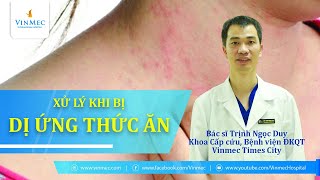 Top 20 cách chữa dị ứng thức ăn tại nhà hay nhất