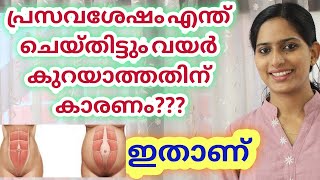 പരസവശഷ വയർ കറയതരകകനളള കരണ? How To Check For Diastasis Recti Malayalam Self Testing