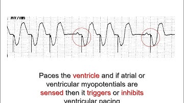 Dr. Manny Learnshop: Temporary cardiac pacing  Part 2