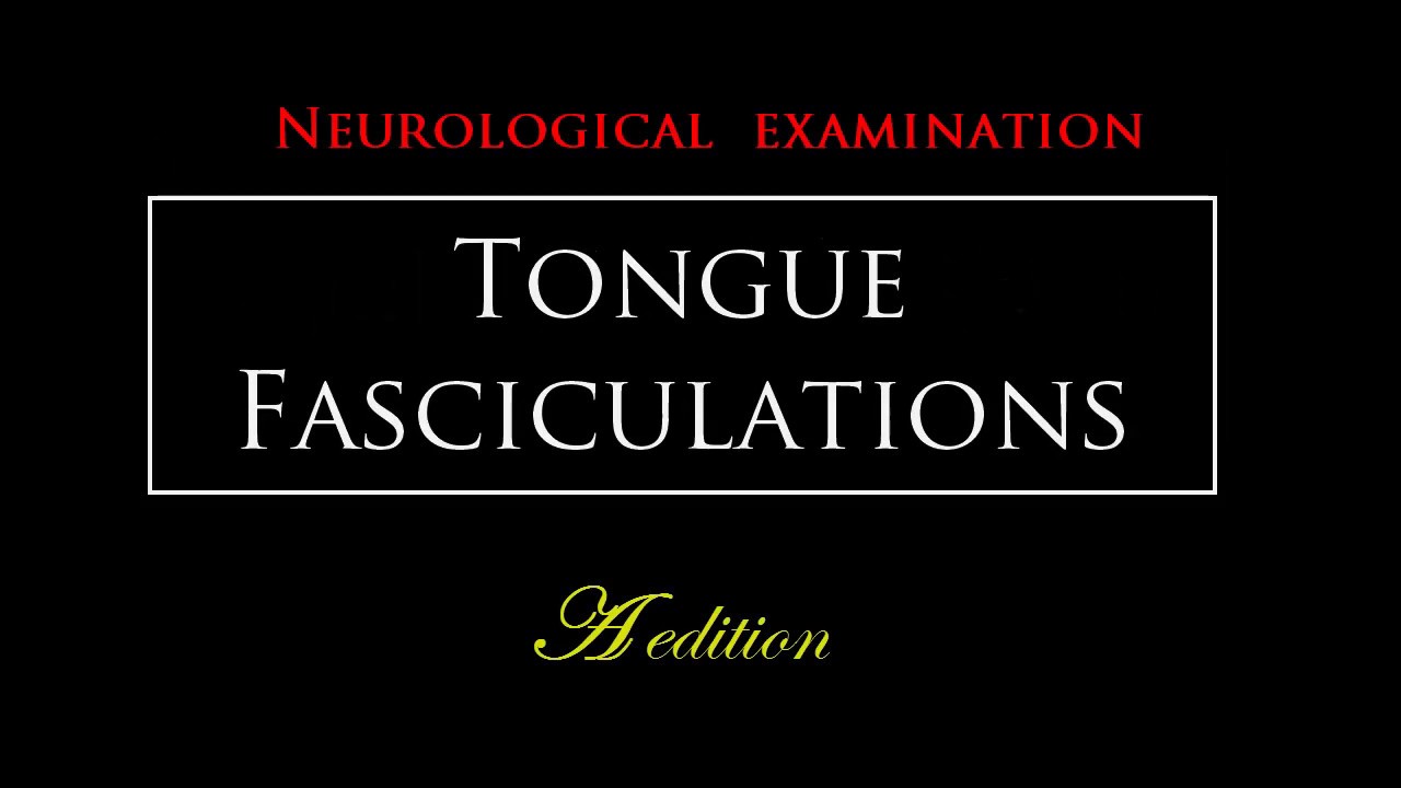 Tongue fasciculations YouTube
