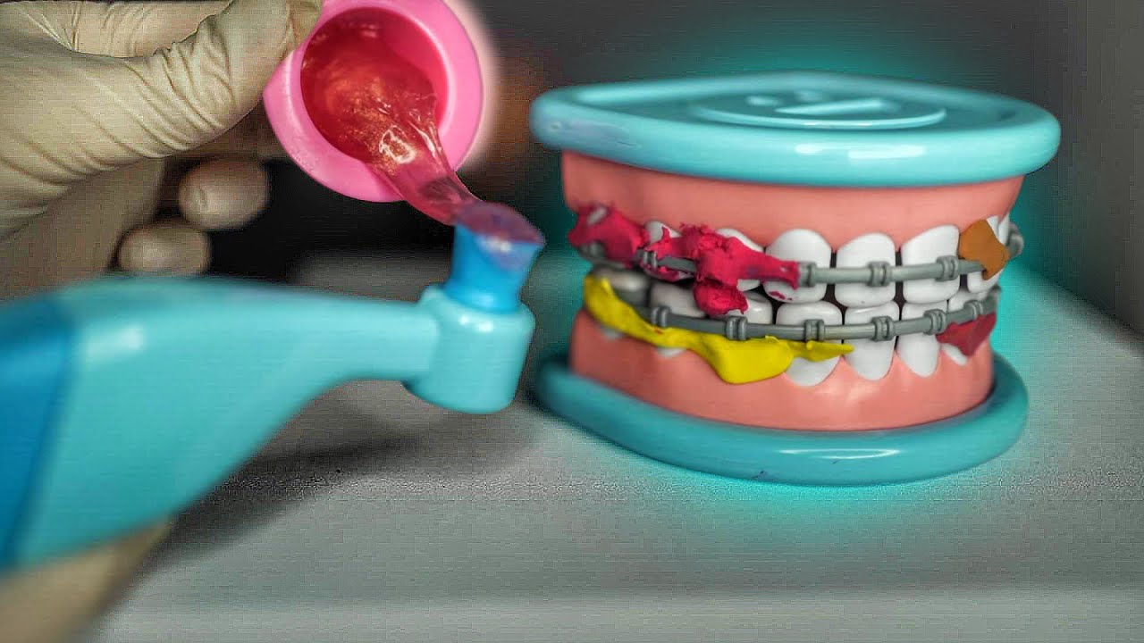 ASMR LIMPANDO SEU APARELHO NO DENTISTA - Sweet Carol