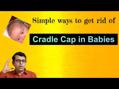 Video: Cradle Cap La Adulți: Tratament, Cauze, Recomandări Despre Produse