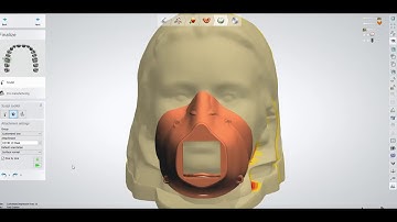 Customized Face Mask 3Shape Design Workflow