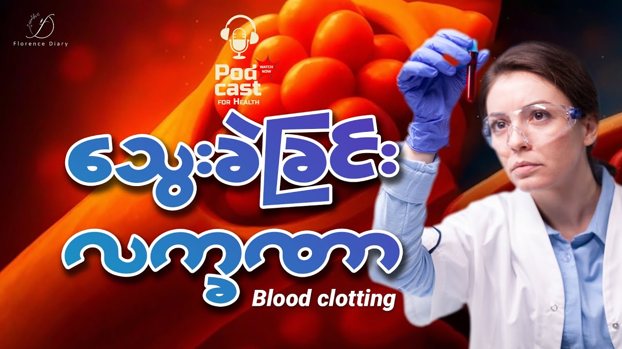 သွေးခဲခြင်း ကာကွယ်ဖို့ ဂရုပြုကြစို့။ (blood clotting)
