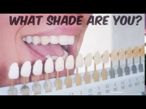 what shade are your teeth youtube instasmile color chart