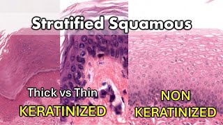 Keratinized vs Non Keratinized, Thick vs Thin by Anatomy Hero 6,634 views 4 months ago 7 minutes, 43 seconds