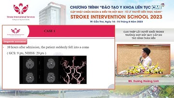 Can thiệp lấy huyết khối trong trường hợp đột quỵ cấp do tắc đỉnh thân nền - BS. Dương Hoàng Linh