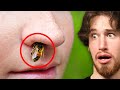 He Inhaled a Bee...